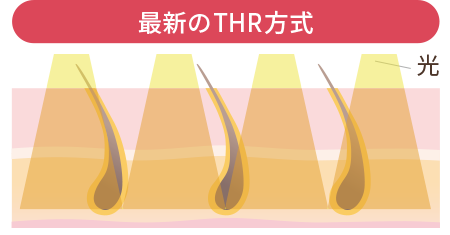 THR方式の家庭用ムダ毛ケア器